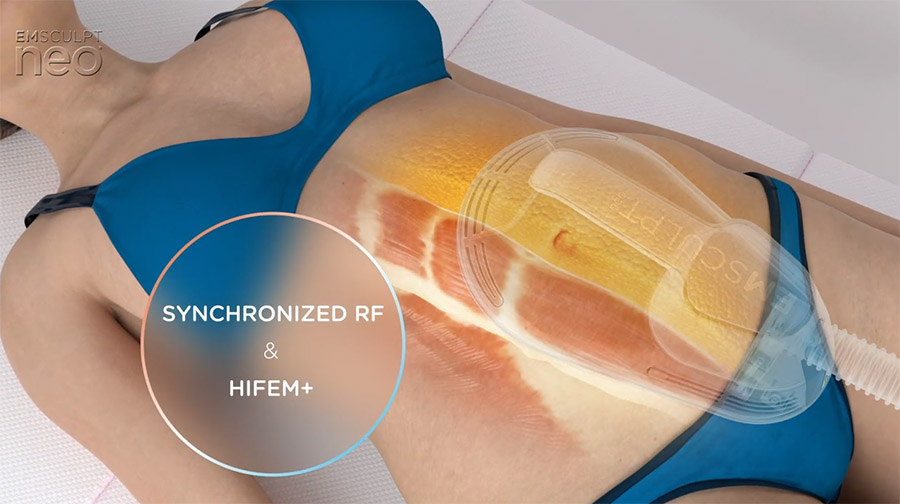 How EMSCULPT NEO HIFEM+RF functional wellness therapy works at Novaré