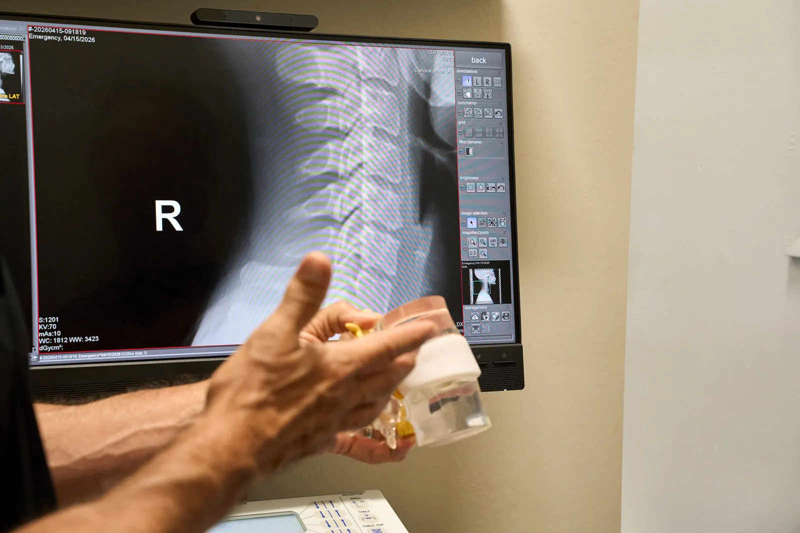 Clinician reviewing spinal X-ray during personal injury evaluation