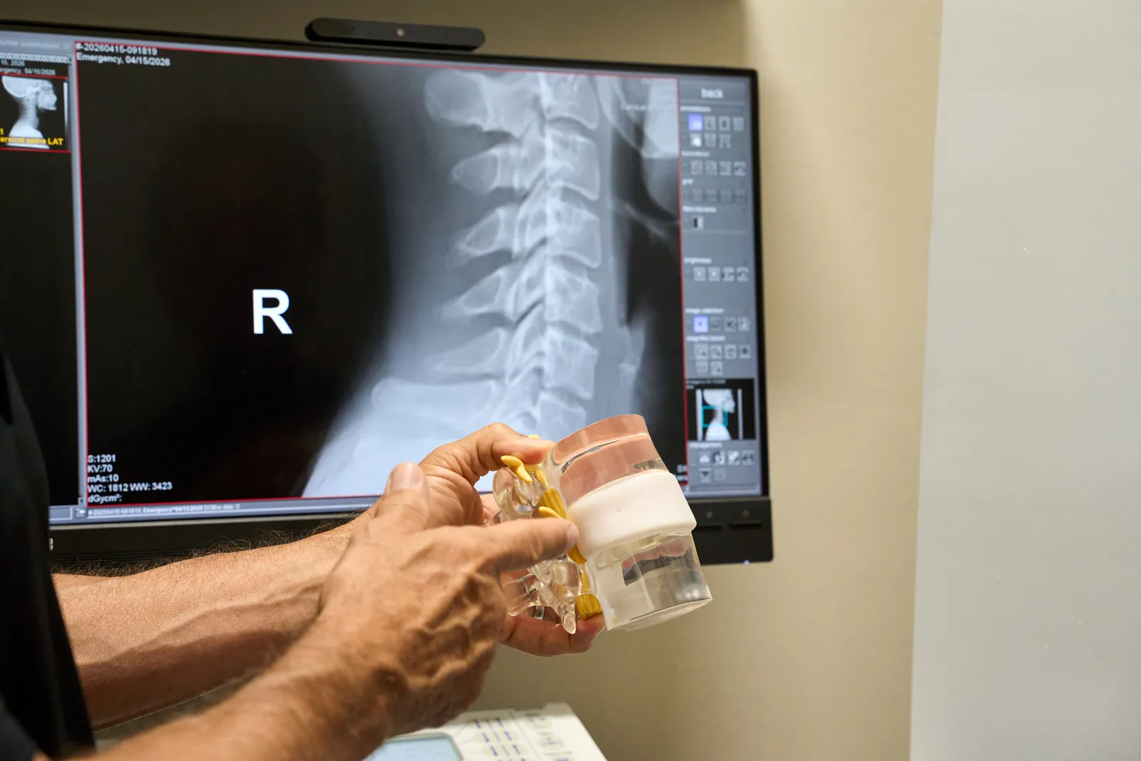 Clinician holding a spine model in front of a side-view neck x-ray at Novaré Injury Care and Rehab